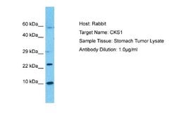 CKS1 Antibody, Novus Biologicals 100 &mu;L | Buy Online | Novus Biologicals | Fisher Scientific